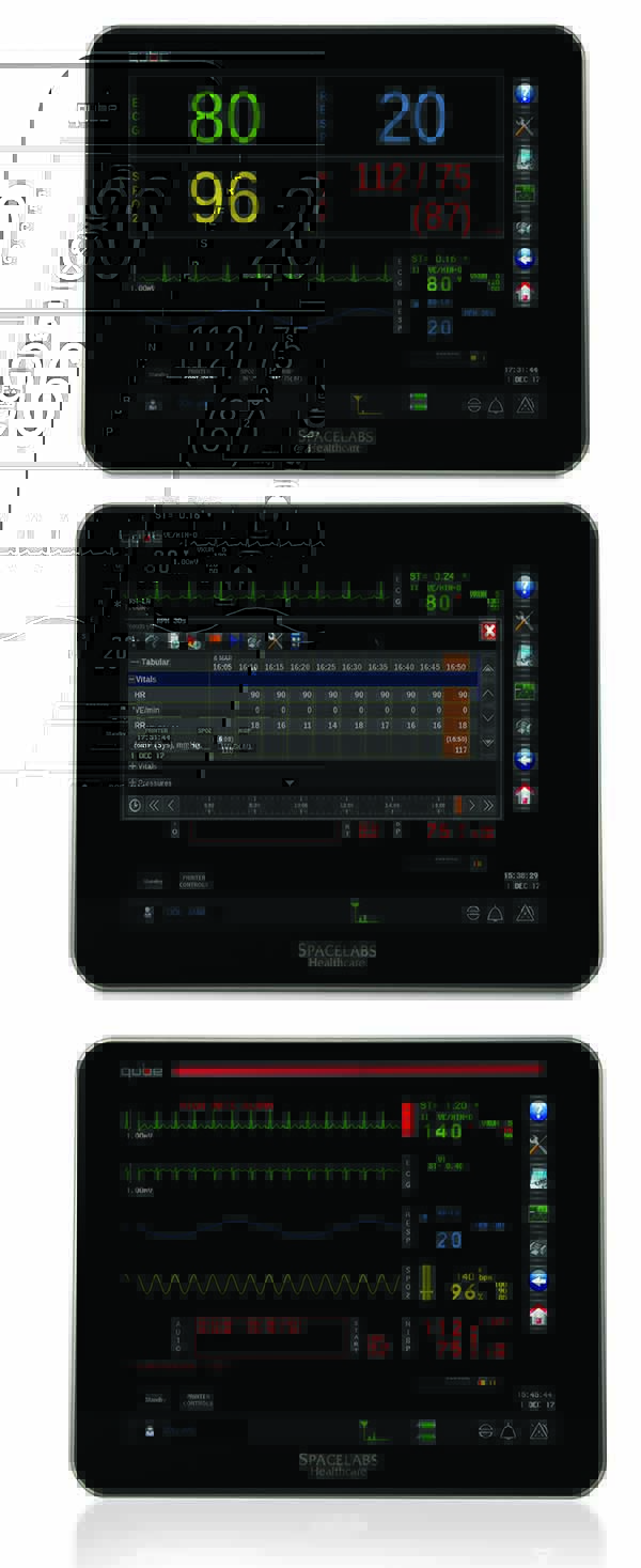 Qube® Compact Bedside Monitor