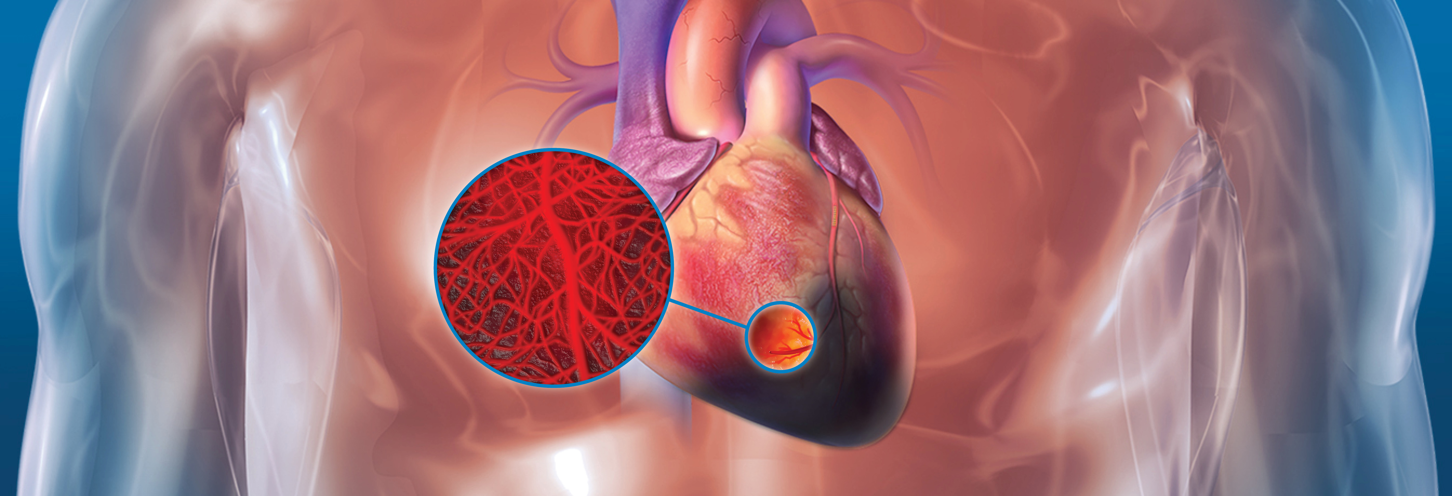 TherOx SSO₂ System